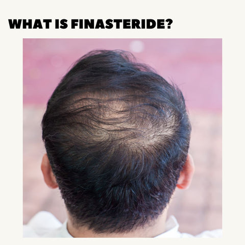 What is Finasteride?