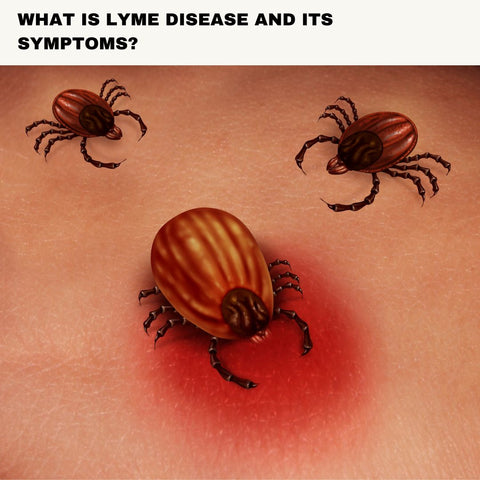 What is Lyme Disease and Its Symptoms?