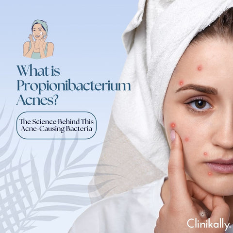 What is Propionibacterium Acnes? The Science Behind This Acne-Causing Bacteria