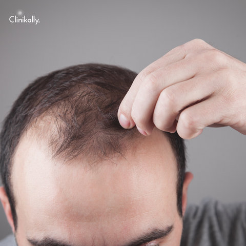 Is eugenol good for your hair?