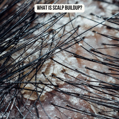 What is Scalp Buildup?