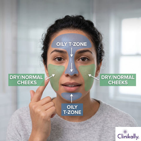 women showing oily T-zone and dry cheeks on combination skin