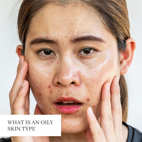 What is an Oily Skin Type