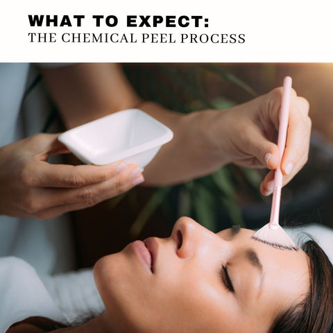 What to Expect: The Chemical Peel Process