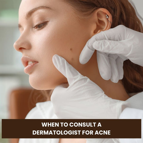 When to Consult a Dermatologist for Acne