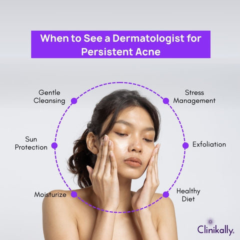 When to See a Dermatologist for Persistent Acne