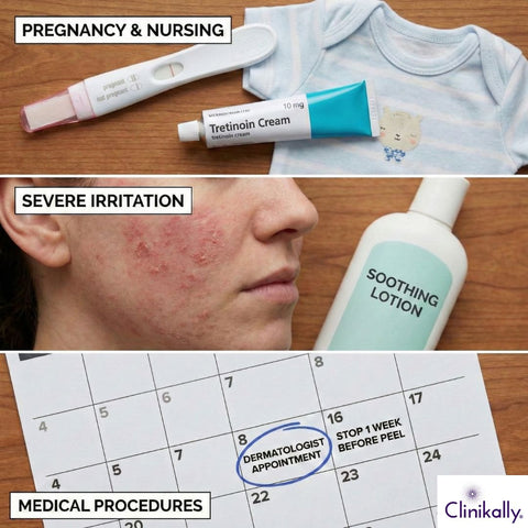 When to Stop Tretinoin Treatment