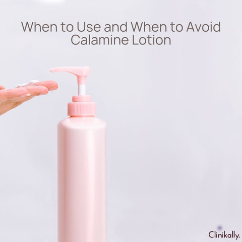 When to Use and When to Avoid Calamine Lotion