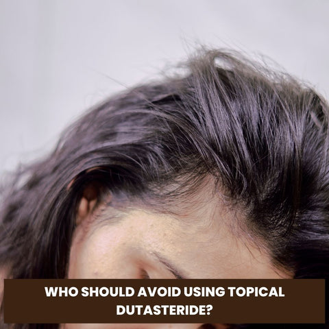 Who Should Avoid Using Topical Dutasteride?