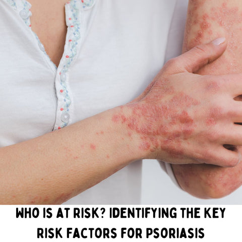 Who is at Risk? Identifying the Key Risk Factors for Psoriasis