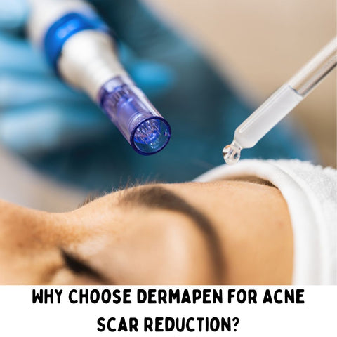 Why Choose Dermapen for Acne Scar Reduction?