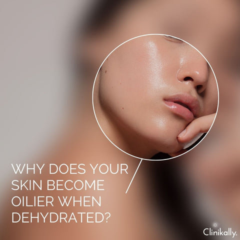 Why Does Your Skin Become Oilier When Dehydrated?