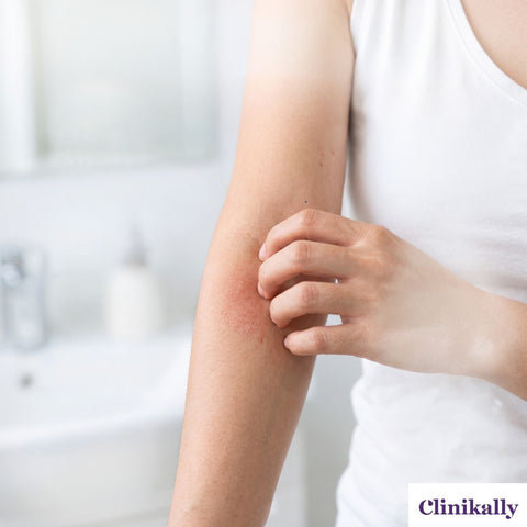 Itchy skin and rash symptoms