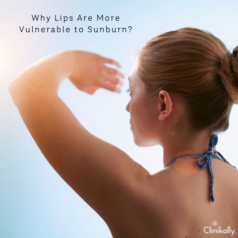 Why Lips Are More Vulnerable to Sunburn?