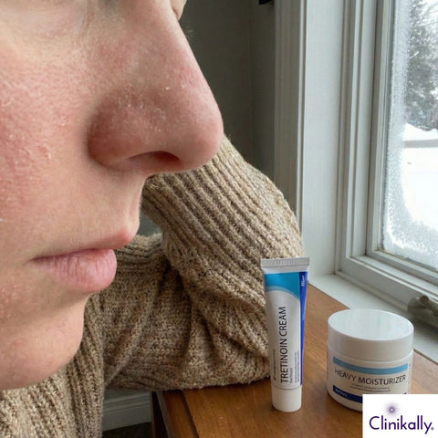 Why Winter Affects Tretinoin Use