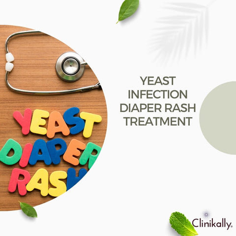 Yeast infection diaper rash treatment