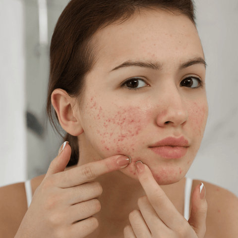 What do retinoids do for your skin?