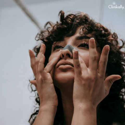 how to remove blackheads from nose