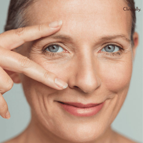 eyelid eczema 