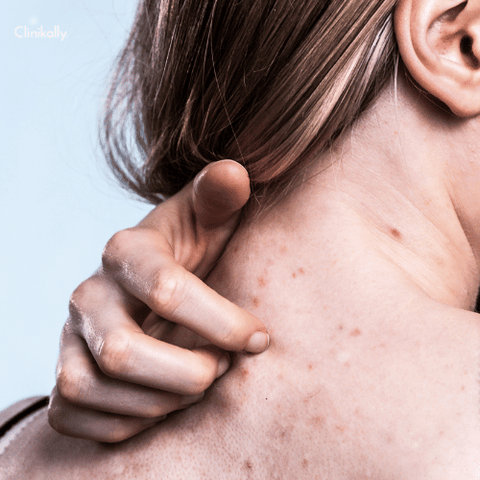 Allergens in Cosmetics