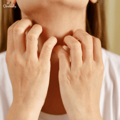 Is beta glucan good for skin