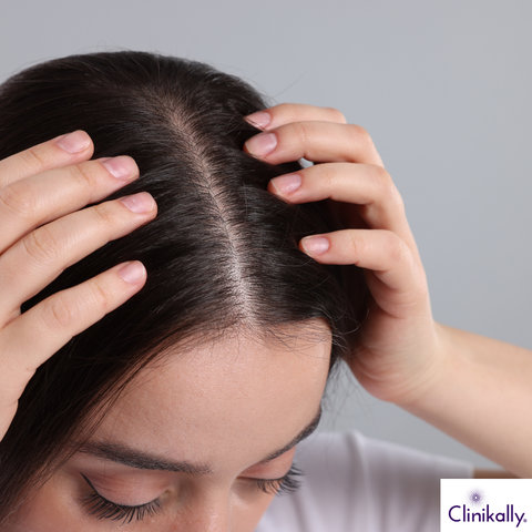 Soothes Scalp & Reduces Inflammation