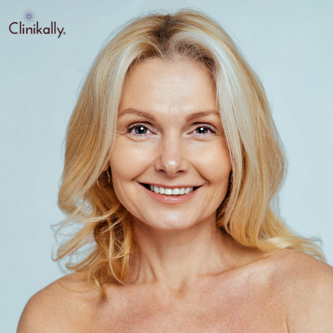 dehydration lines and wrinkles 